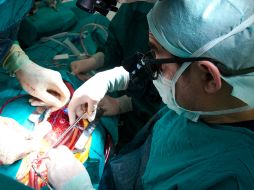 Estos polímeros están diseñados como injertos vasculares de bajo calibre para zonas cercanas al corazón. ID  /