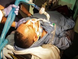 La condición de Camacho se agravó este miércoles, tras recibir ayer un disparo en el cuello y la cara. AP  /