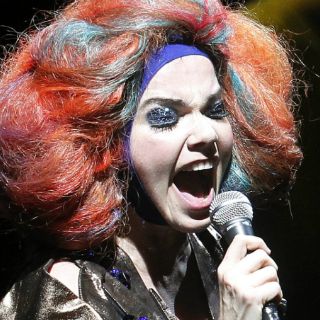 Se recupera Björk de cirugía en cuerdas vocales