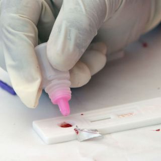 Bajan las cifras sobre casos de Sida en México: Censida