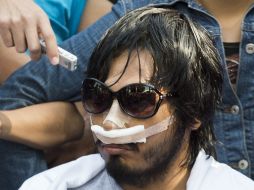 Uriel Sandoval sale del hospital; durante el mensaje a los medios de comunicación pide justicia y la liberación de los detenidos. AFP  /