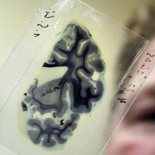 El científico español Rafael Yuste, promesa para 2013