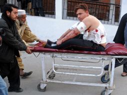 Personas trasladan a un trabajador herido en el ataque. XINHUA  /