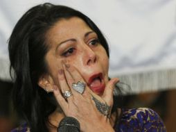 Los médicos de la cantante han informado que la artista requerirá de seis semanas de recuperación. ARCHIVO EL INFORMADOR /