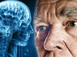 Se estima que hay unos 36 millones de enfermos de alzheimer en el mundo. ID  /
