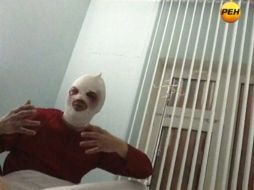 Fotografía tomada de un video televisivo, donde Serguéi Filin es entrevistado en el hospital. AP /