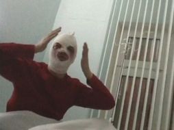 La evolución de Filin, que ha sido operado dos veces de los ojos y una de la piel desde el ataque. REUTERS /