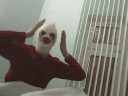 Serguéi Filin sufrió graves quemaduras en el rostro después de ser atacado con un ácido. ARCHIVO /