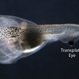 El cerebro puede procesar datos visuales sin conexión con los ojos