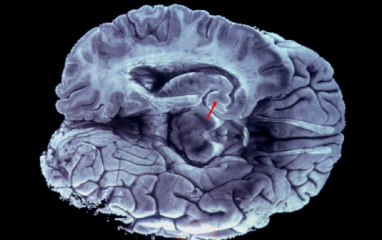 Una enzima, la telomerasa, opera como un factor de crecimiento que permite que la célula continúe proliferando. EFE /