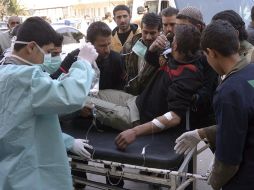 Un hombre recibiendo asistencia médica tras sufrir un ataque en Alepo. EFE /