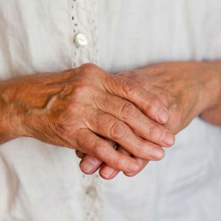 Terapias biotecnológicas mejoran vida de pacientes con artritis