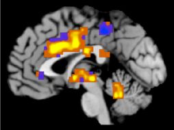 Estudios demuestran que la dopamina interviene en esta respuesta en las áreas estriadas del cerebro. AFP /