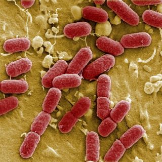 La bacteria E. Coli puede producir diesel