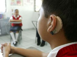 El implante coclear permite cobrar el sentido del oído a quienes padecen sordera profunda.  /