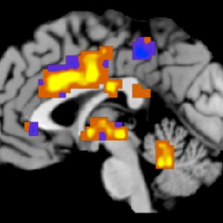 Atacan la epilepsia con impulsos eléctricos