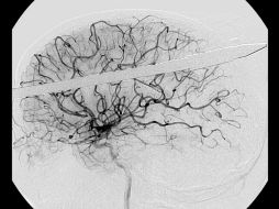 Las personas con daño cerebral pueden conocer una nueva propuesta de tratamiento de rehabilitación física de sus funciones. ARCHIVO /