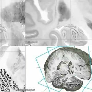 Presentan modelo de cerebro humano en 3D y alta resolución