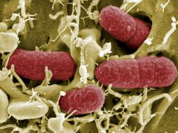 La Escherichia colies un tipo de bacteria que puede crecer y metabolizar tanto en presencia como en ausencia de oxígeno. ARCHIVO /