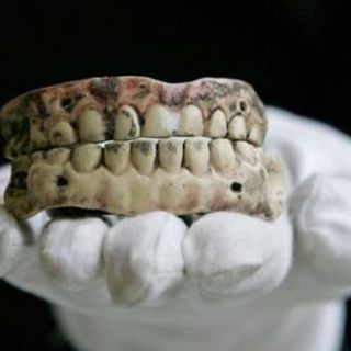 La caries puede detonar afecciones cardiacas