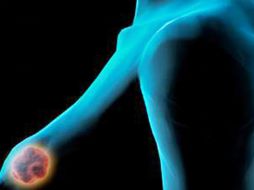 La aplicación permite a las mujeres identificar irregularidades con mediciones mensuales. ARCHIVO /