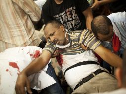 Voluntarios ayudan a un hombre, herido tras lo choques entre manifestantes. AP /