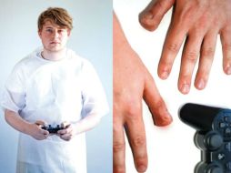 Fotos de jugadores de video con repercusiones en sus cuerpos empiezan a circular en Internet. ESPECIAL /