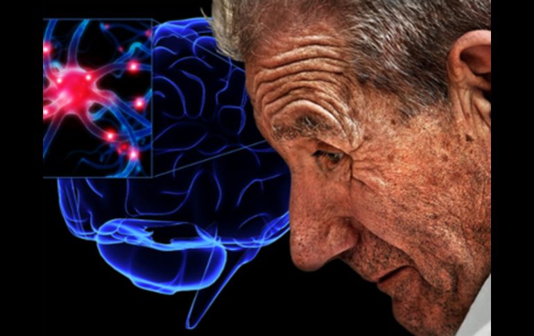 Dos cámaras infrarrojas captan la posición en tres dimensiones de alguna parte del paciente. ARCHIVO /