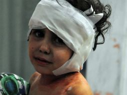 Niña herida en un hospital tras la explosión de un carrobomba en la periferia de Damasco (Siria). EFE /