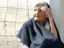 Este padecimiento va de la mano con la exposición a rayos solares. ARCHIVO /