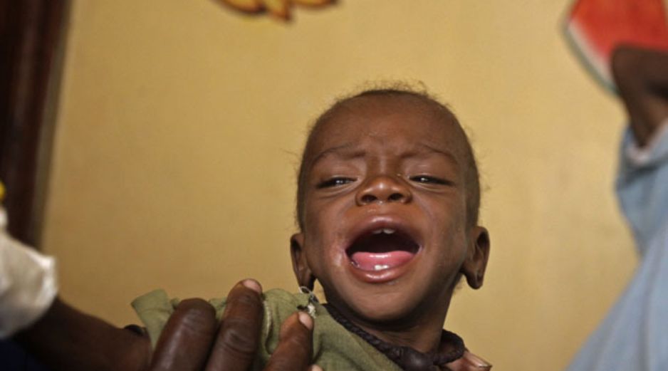 Más de 206 mil niños menores de 5 años padecen malnutrición aguda en el país africano. ARCHIVO /