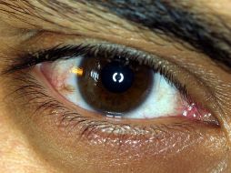 Este avance permitirá a médicos a miles de kilómetros ayudar a pacientes que sufren afecciones a la vista. ARCHIVO /