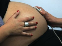 La detección de alergias y el tratamiento oportuno puede mejorar la calidad de vida de los niños. ARCHIVO /