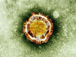 Según la OMS, desde septiembre de 2012 a la fecha se han registrado 58 muertes ocasionadas por el nuevo coronavirus. ARCHIVO /