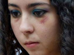 María Luz Salcedo, ''Lucero'', joven víctima de violencia física y sexual en Guanajuato, ha denunciado la ''misoginia'' en el Estado. ESPECIAL /