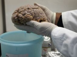 La mutación genética ha sido igualmente relacionada con un incremento en las posibilidades de desarrollar el Parkinson. ARCHIVO /