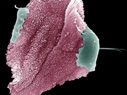 Las células afectadas por el cáncer podrán ser detectadas gracias a instrumentos de identificación con nanopartículas de oro. ARCHIVO /