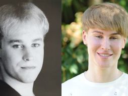 Toby Sheldon antes de las intervenciones estéticas (i) y después (d). ESPECIAL /