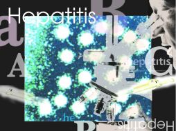 Uno de los puntos débiles es que es menos efectivo en pacientes con una mutación genética común denominada Q80K. ARCHIVO /