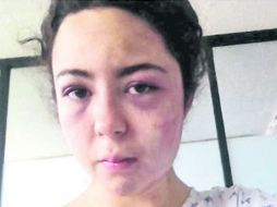 Lucero, de 18 años, ha denunciado la “misoginia” que se vive en el estado y la falta de apoyo de las autoridades. ARCHIVO /