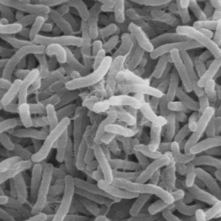 Suman 180 casos de cólera en el país: Secretaría de Salud