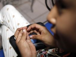 EL INFORMADOR publicó que la Secretaría de Salud no tiene un registro de los pacientes infantiles con la enfermedad. ARCHIVO /