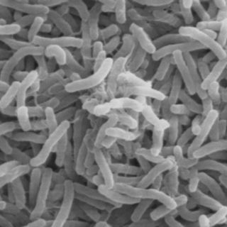 Descartan nuevos casos de cólera en Hidalgo