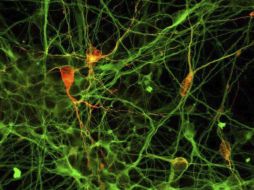 El control de los niveles de azúcar en sangre se realiza con una dieta, medicamentos y deporte. ARCHIVO /