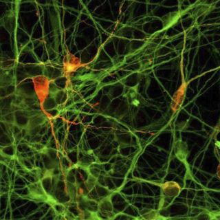 La neuropatía afecta a casi todos los diabéticos: experto