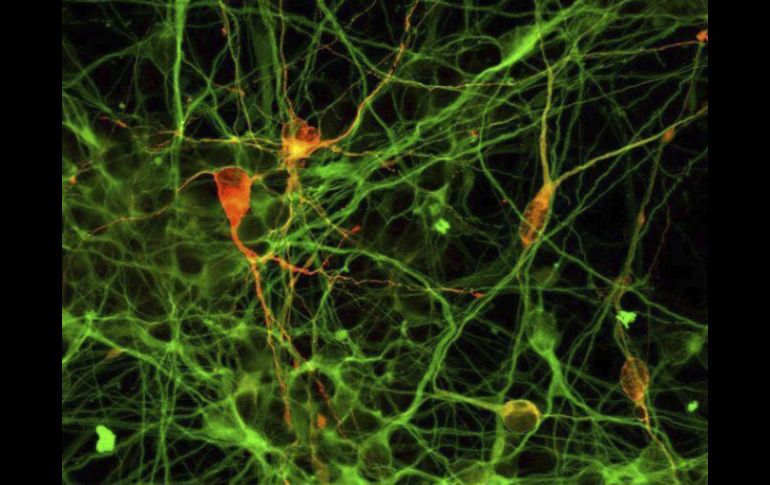 El control de los niveles de azúcar en sangre se realiza con una dieta, medicamentos y deporte. ARCHIVO /