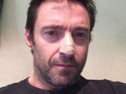 'Háganse revisiones. ¡¡¡ Y usen crema solar !!!', escribió el actor en su cuenta de Instagram. ESPECIAL /