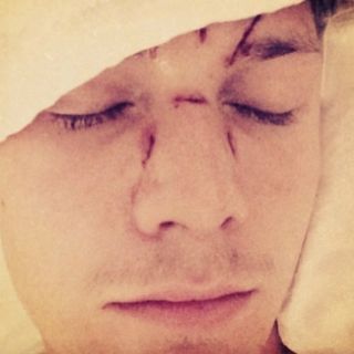 Hermano de Paris Hilton demandará a Lindsay Lohan