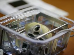 El corazón high-tech cuesta unos 220 mil dólares, tanto como el trasplante y gastos de operación. AP /