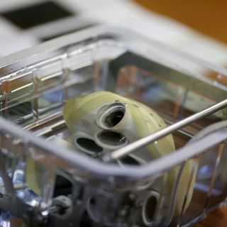 Primer corazón artificial, implantado en Francia